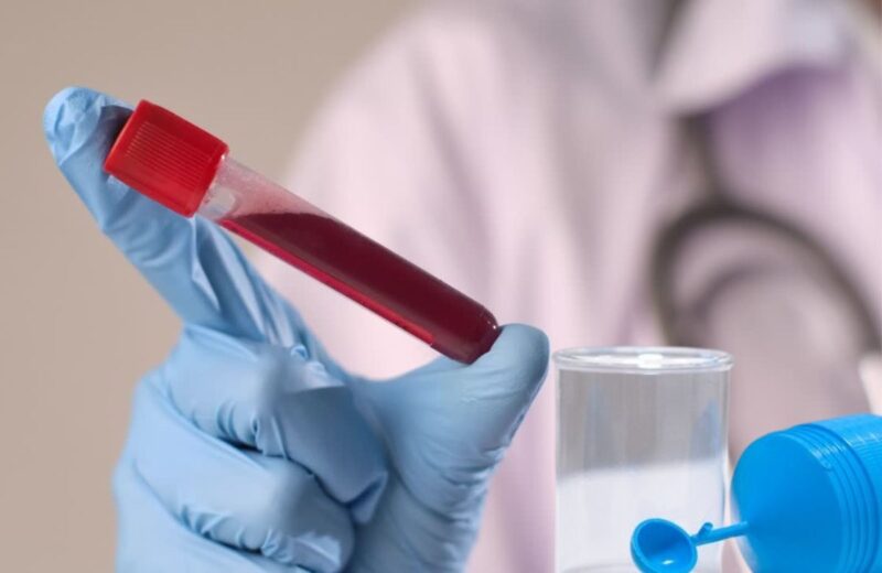 Analize stolice i krvi pomažu dijagnozi parazita, dok prirodna terapija podržava medicinske tretmane.